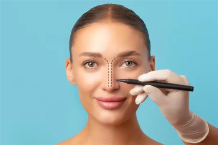 مراقبت‌های ضروری بعد از جراحی بینی استخوانی از روز اول تا یک سال