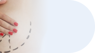 جراحی زیبایی