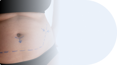 جراحی زیبایی