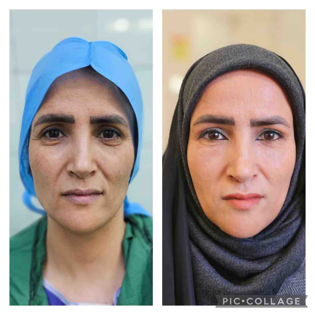 جراحی زیبایی