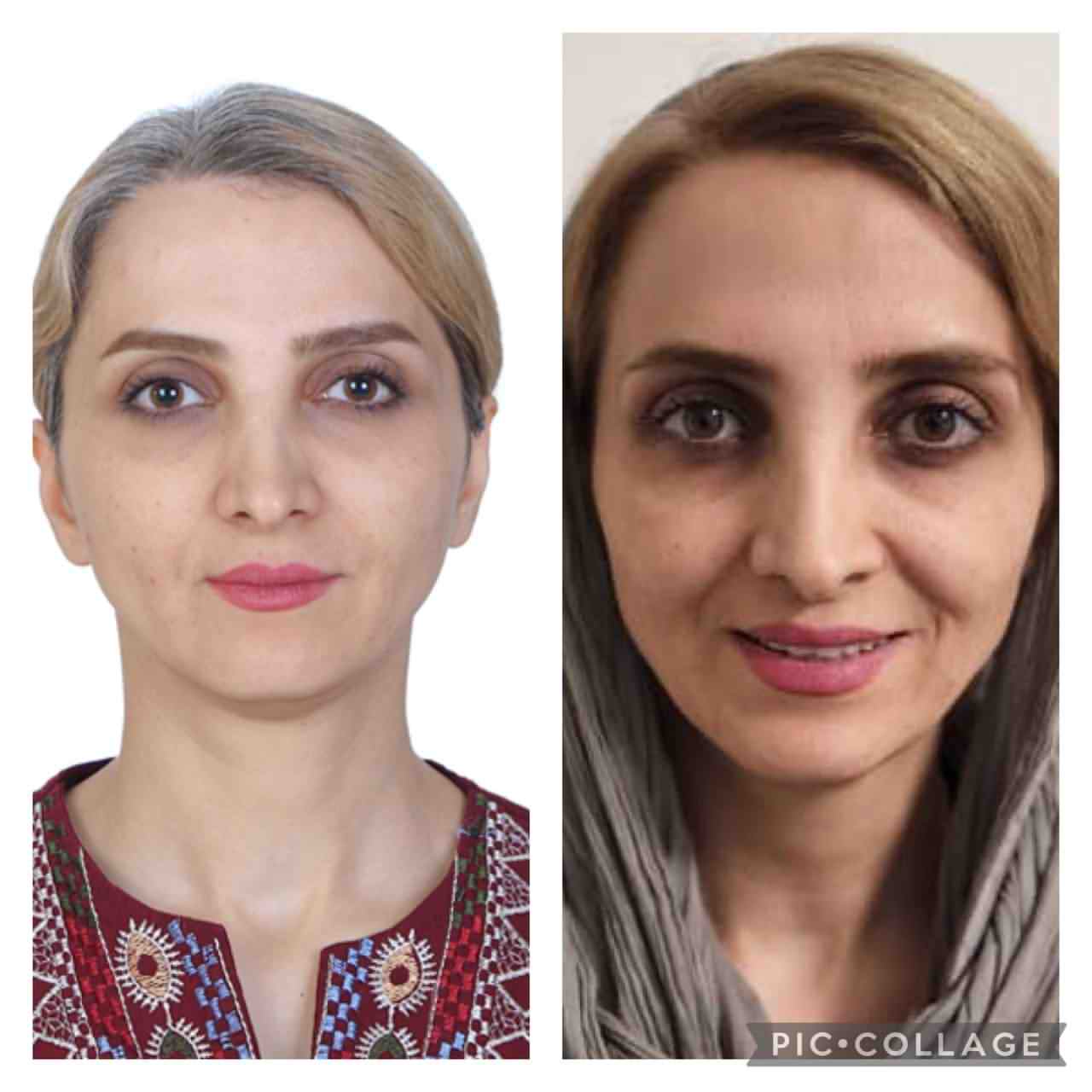 جراحی زیبایی