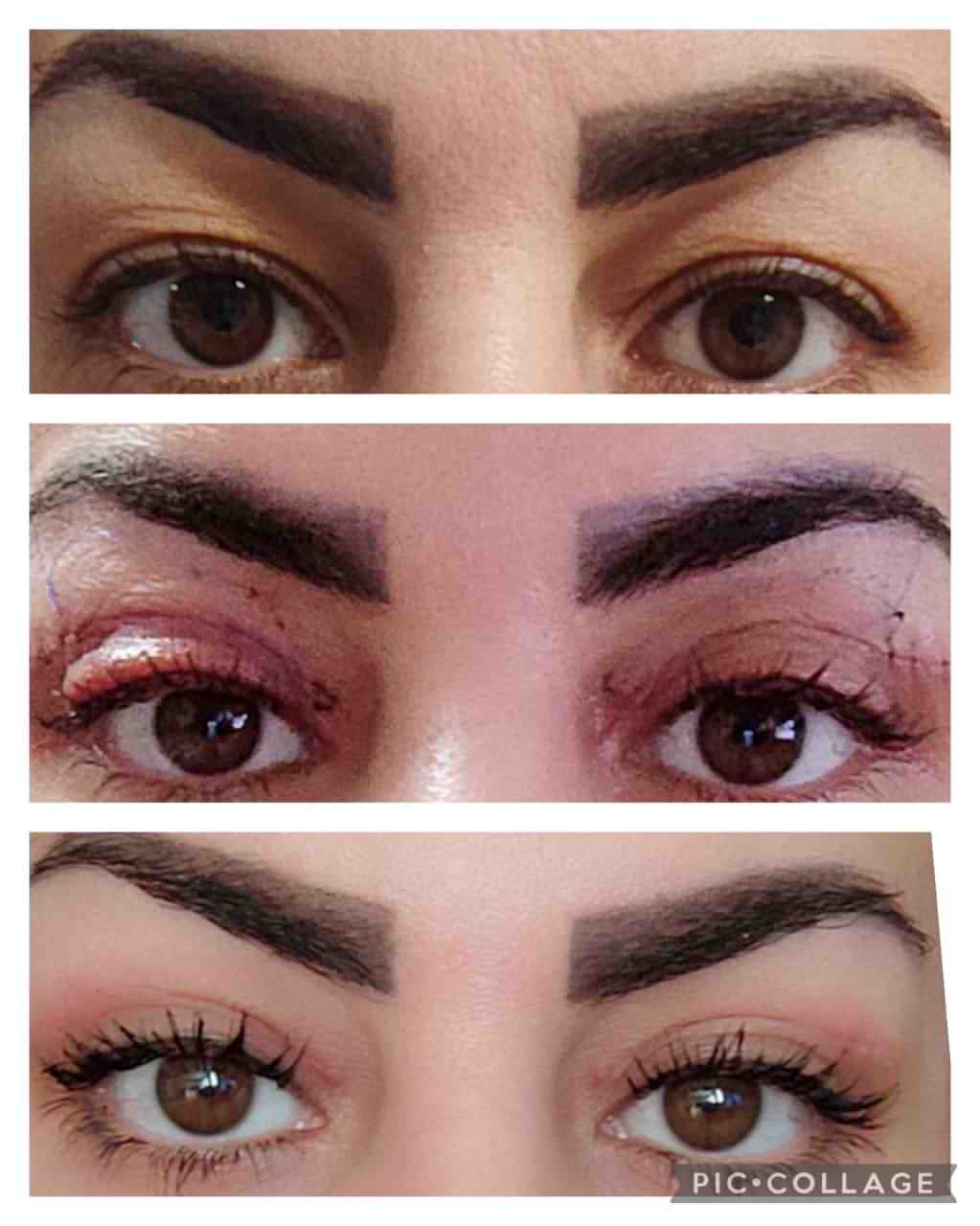 جراحی زیبایی