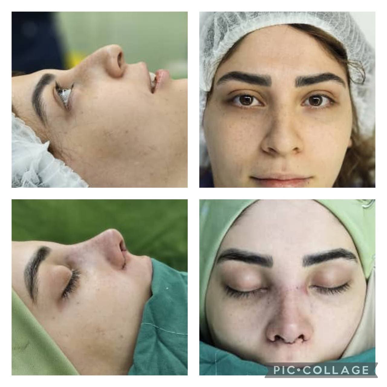 جراحی زیبایی