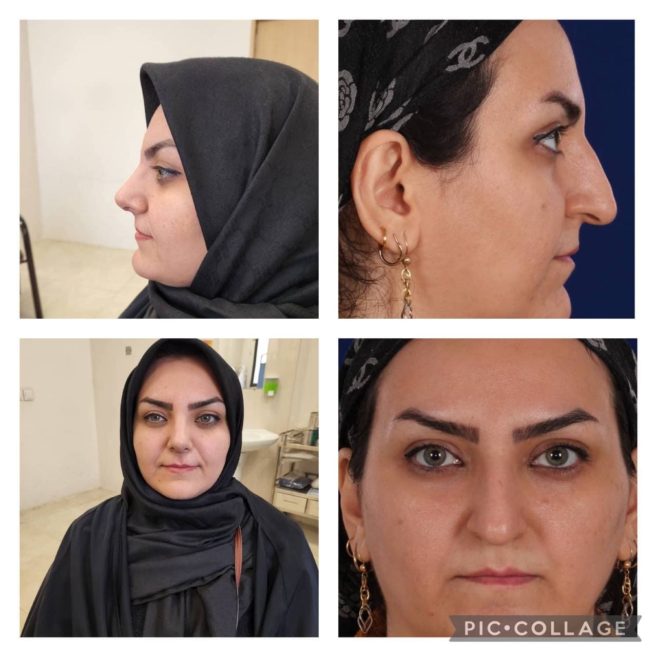 جراحی زیبایی