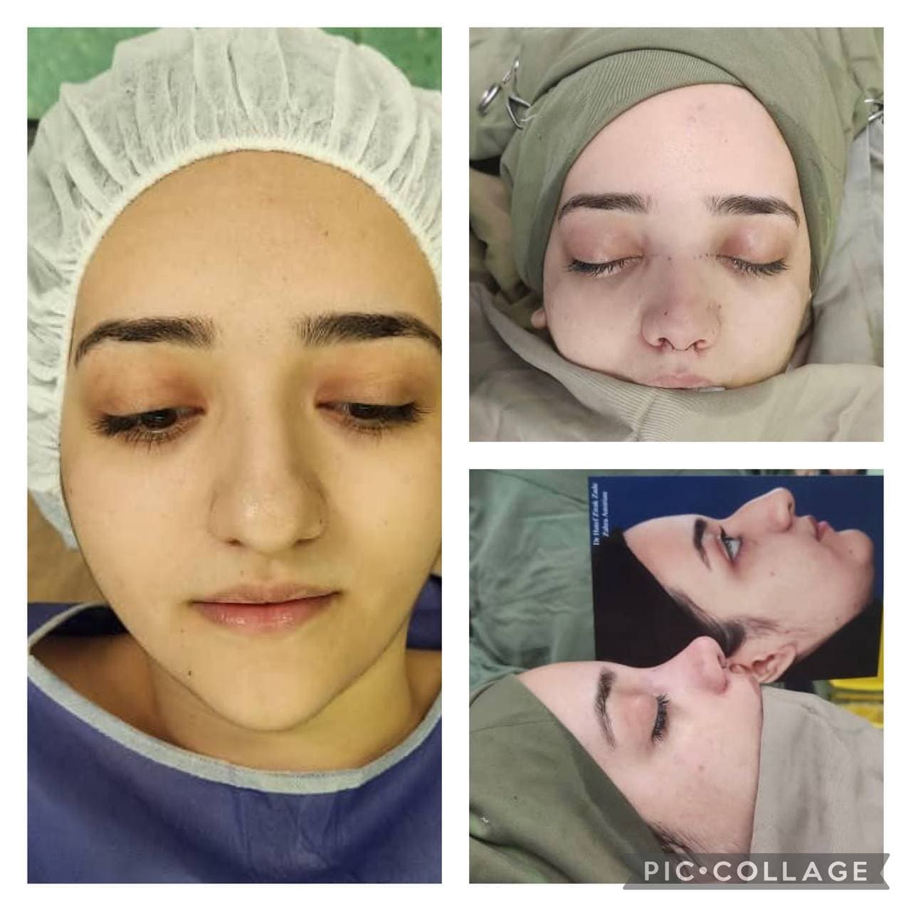 جراحی زیبایی