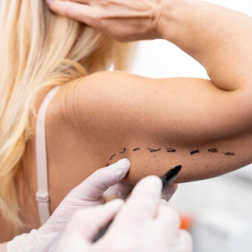 جراحی زیبایی