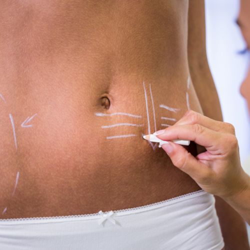 جراحی زیبایی