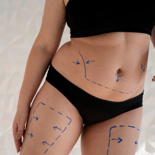 جراحی زیبایی