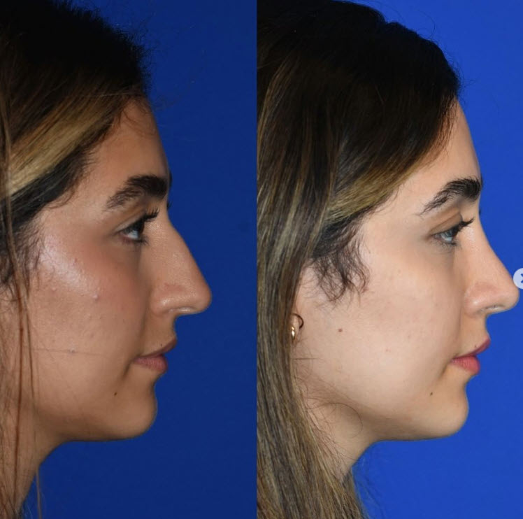 جراحی زیبایی