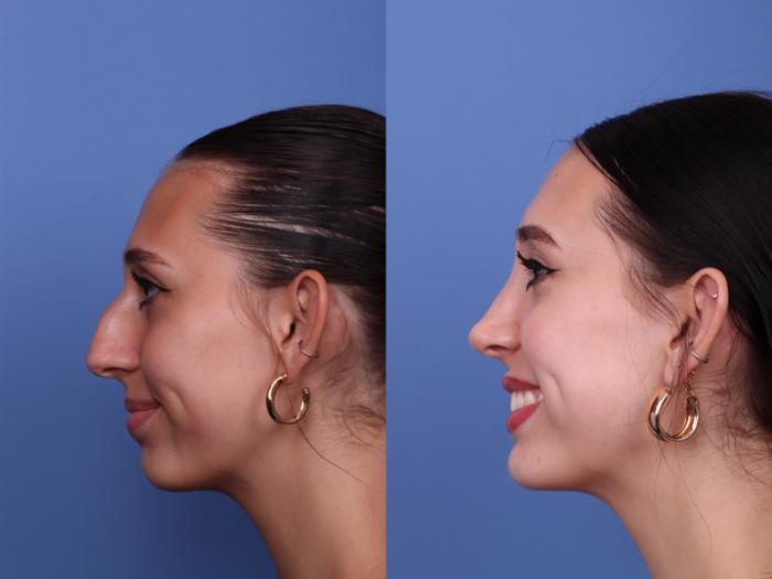 جراحی زیبایی